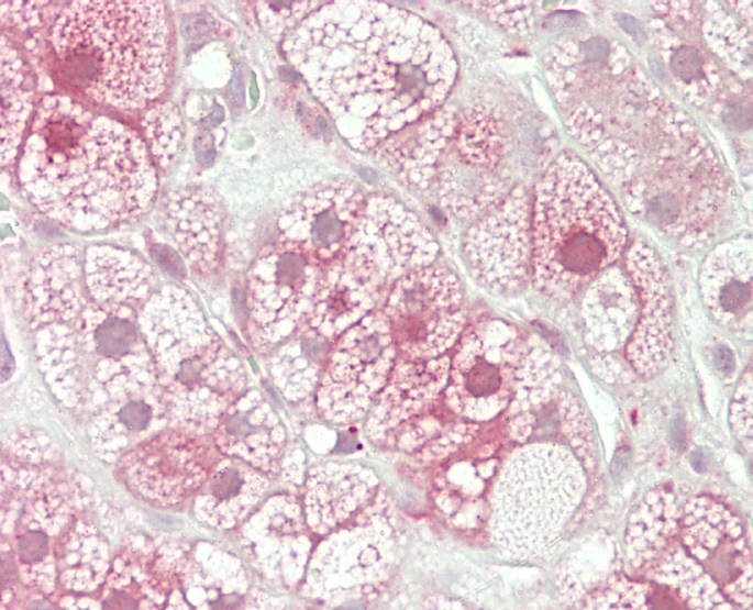 14 - UBE2S Antibody (C-term) AP20071b