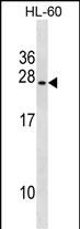 1 - UBE2S Antibody (C-term) AP20071b