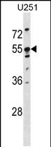 1 - KRT86 Antibody (Center) AP20108c