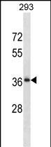 1 - RALYL Antibody (N-term) AP20112a