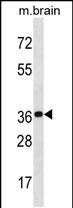 1 - KCTD20 Antibody (C-term) AP20118b