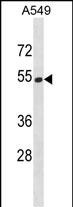 1 - HERPUD2 Antibody (C-term) AP20139b