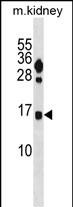 1 - FUNDC2 Antibody (C-term) AP20155b