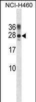 1 - Rat Ppp1r2 Antibody (Center) AP20215c