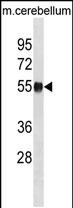 1 - Mouse Ppm1h Antibody (Center) AP20216c