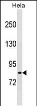1 - LRCH1 Antibody (Center) AP20249c