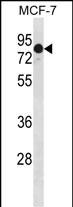 1 - GATAD2A Antibody (N-term) AP20258a