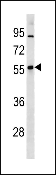 1 - Mouse Znf260 Antibody (N-term) AP20301a