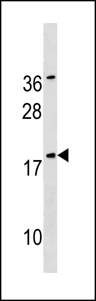 1 - SNX12 Antibody (Center) AP20307c