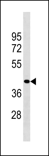 1 - ZCCHC3 Antibody (Center) AP20315c