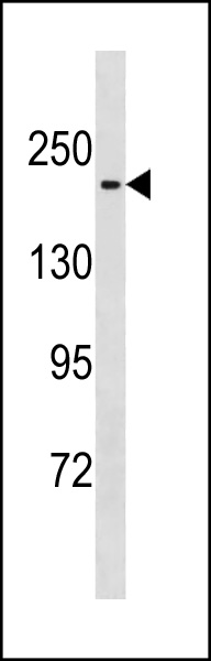 1 - Mouse Mast1 Antibody (C-term) AP20323b