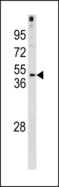 1 - FRA10AC1 Antibody (C-term) AP20372b