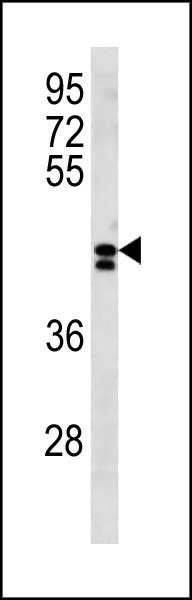 1 - LRRC2 Antibody (N-term) AP20377a