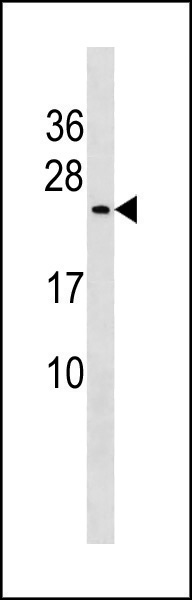 1 - CUTA Antibody (C-term) AP20379b