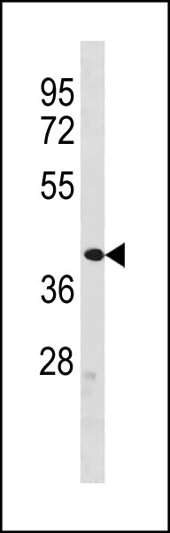 1 - ZFP92 Antibody (N-term) AP20384a