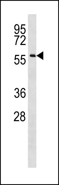 1 - CCDC155 Antibody (Center) AP20386c