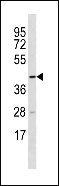 1 - TTC5 Antibody (C-term) AP20388b