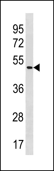 1 - POLE2 Antibody (C-term) AP20396b