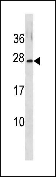 1 - GINS3 Antibody (C-term) AP20401b