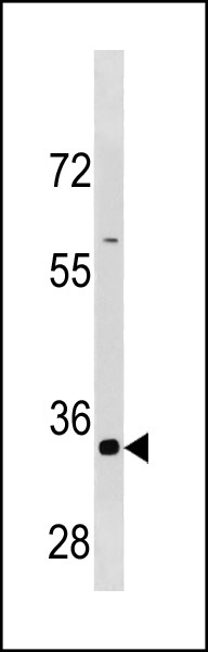 1 - CCNB3 Antibody (C-term S1331/S1333) AP20414b