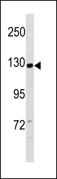 1 - CCD14 Antibody (N-term) AP20428a