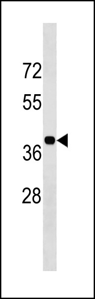 1 - BLVRA Antibody (Center Y83) AP20430c