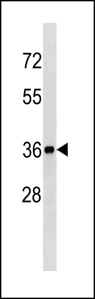 1 - BLVRA Antibody (Center Y83) AP20430c