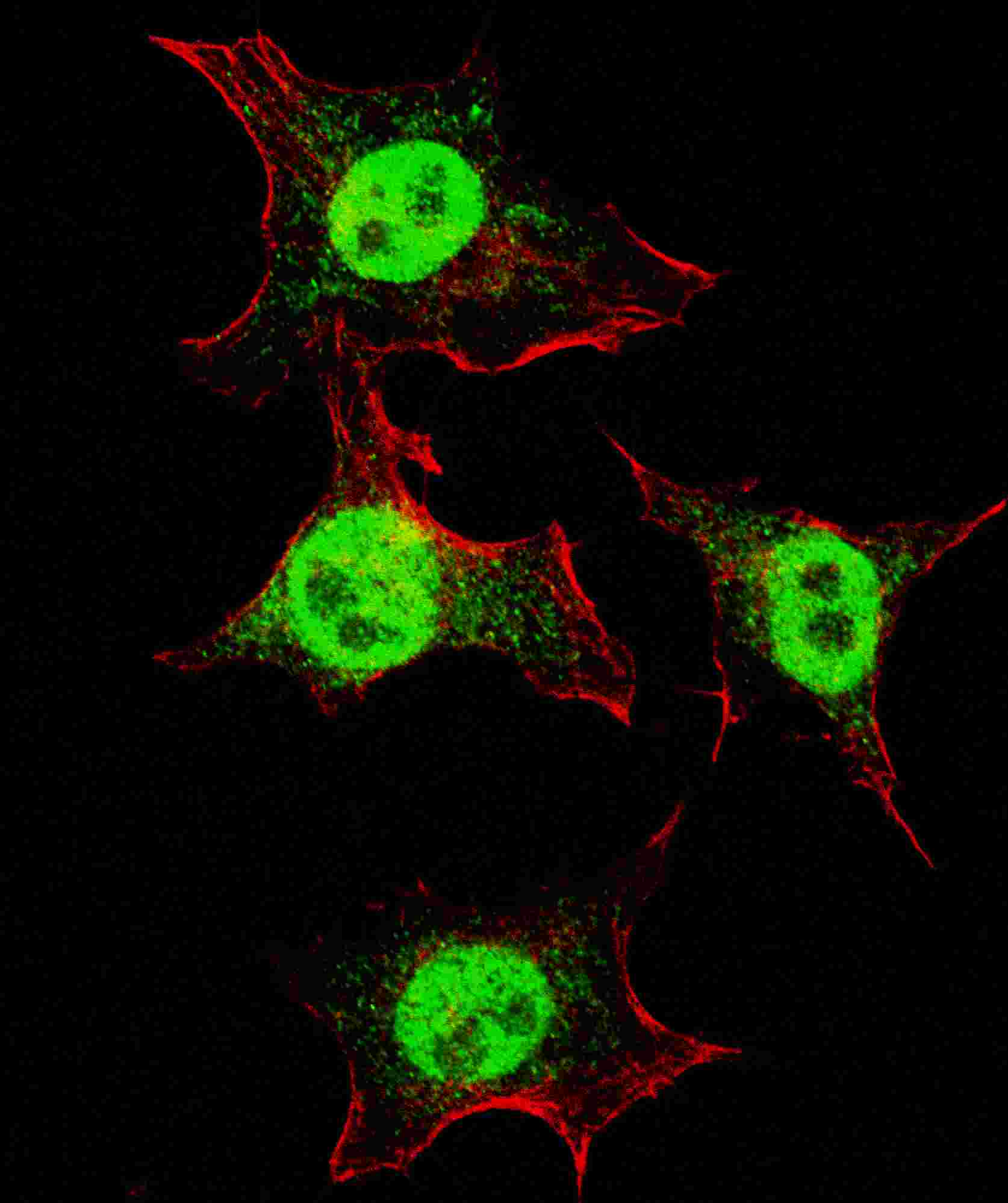 3 - ITGA6 Antibody (isoform 2 S1064) AP2753A