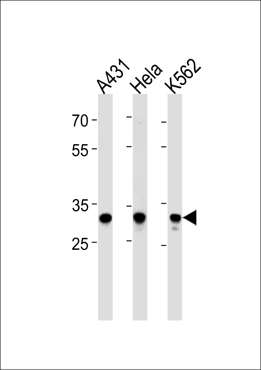 1 - APBB3 Antibody (Center) AP20461c