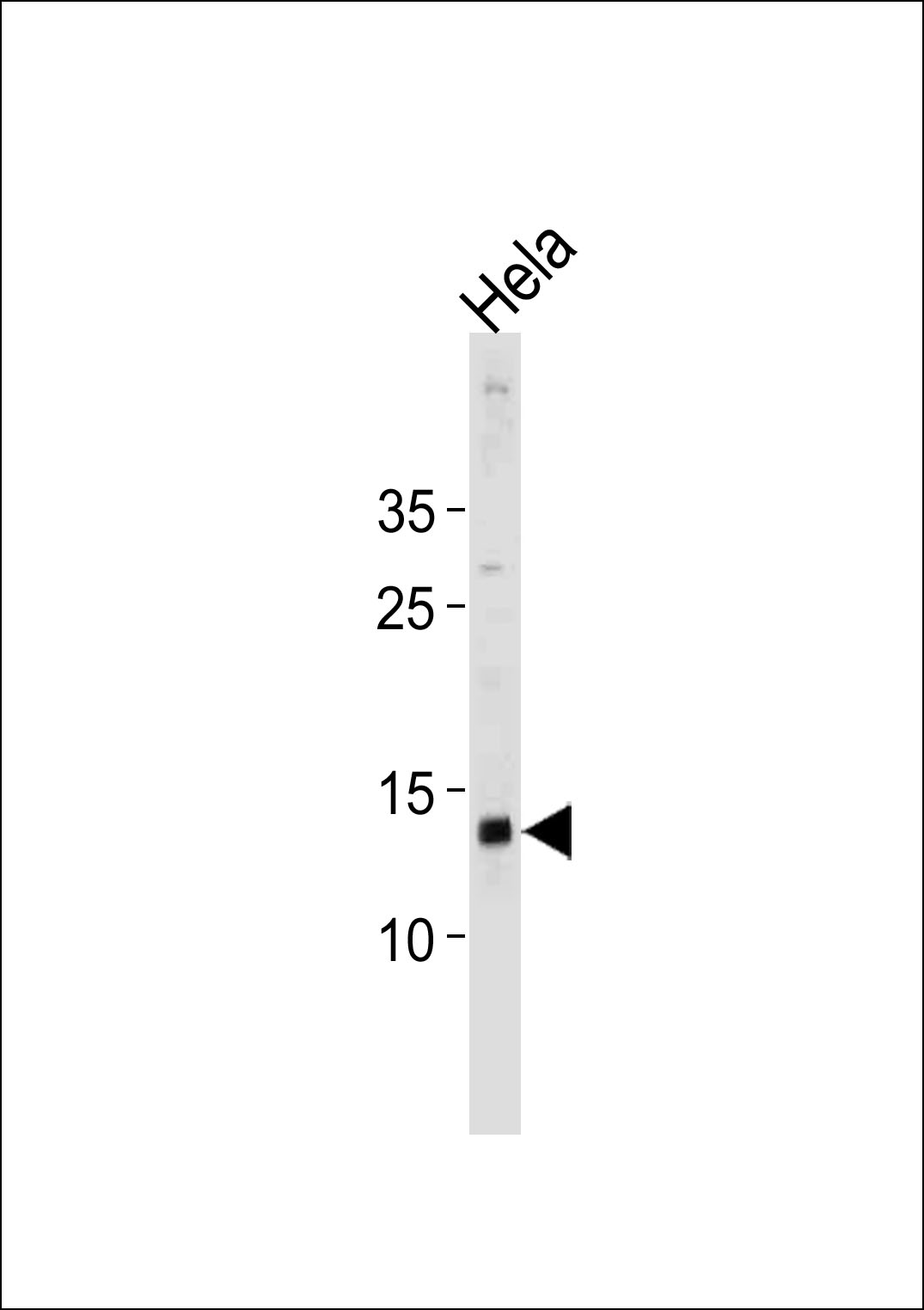 1 - DAP Antibody (N-term) AP20466a