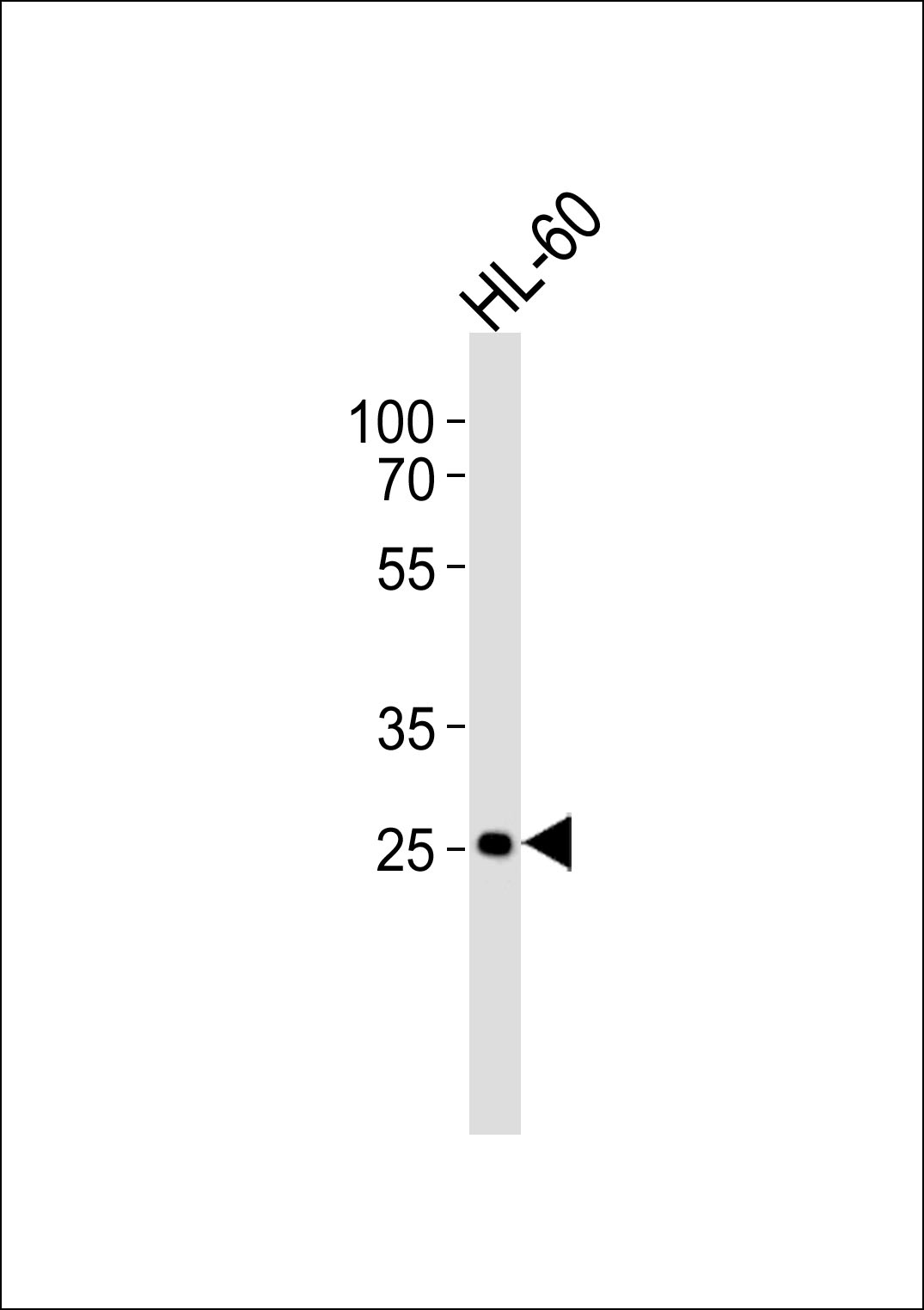 1 - FCGR3B Antibody (N-term) AP20596a