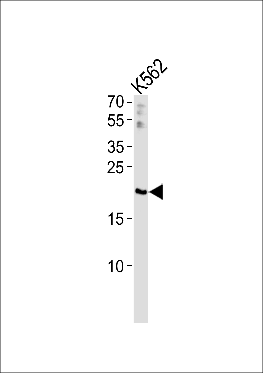 1 - RGS10 Antibody AP50030