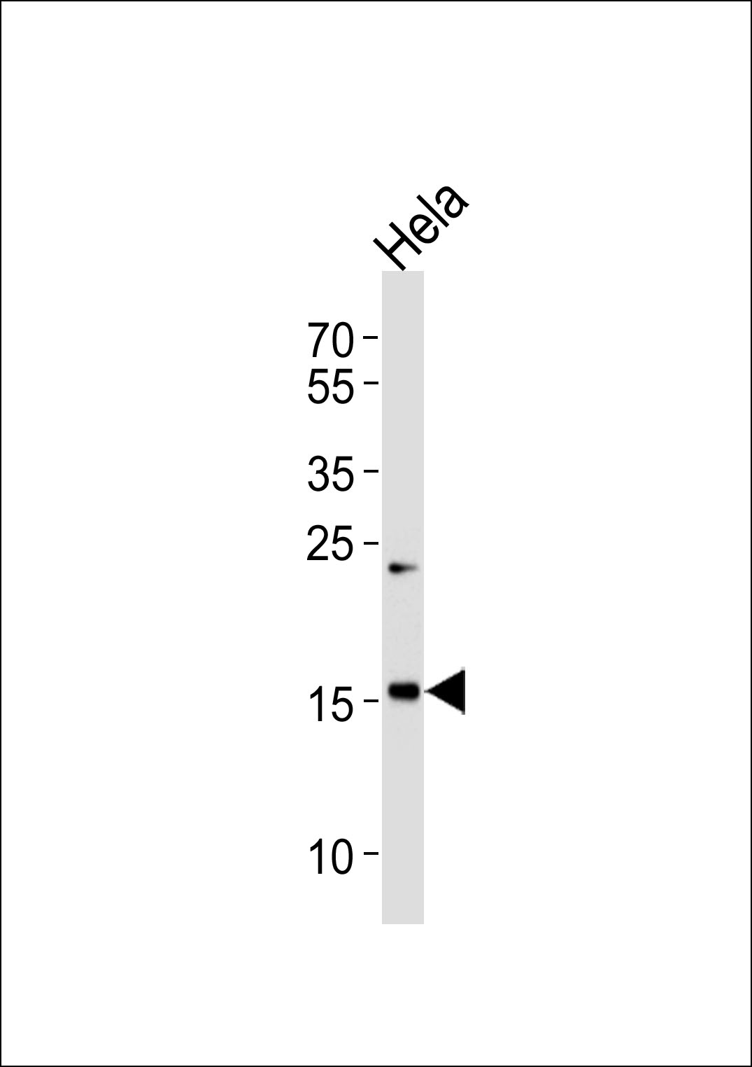 1 - MYL7 Antibody AP50060