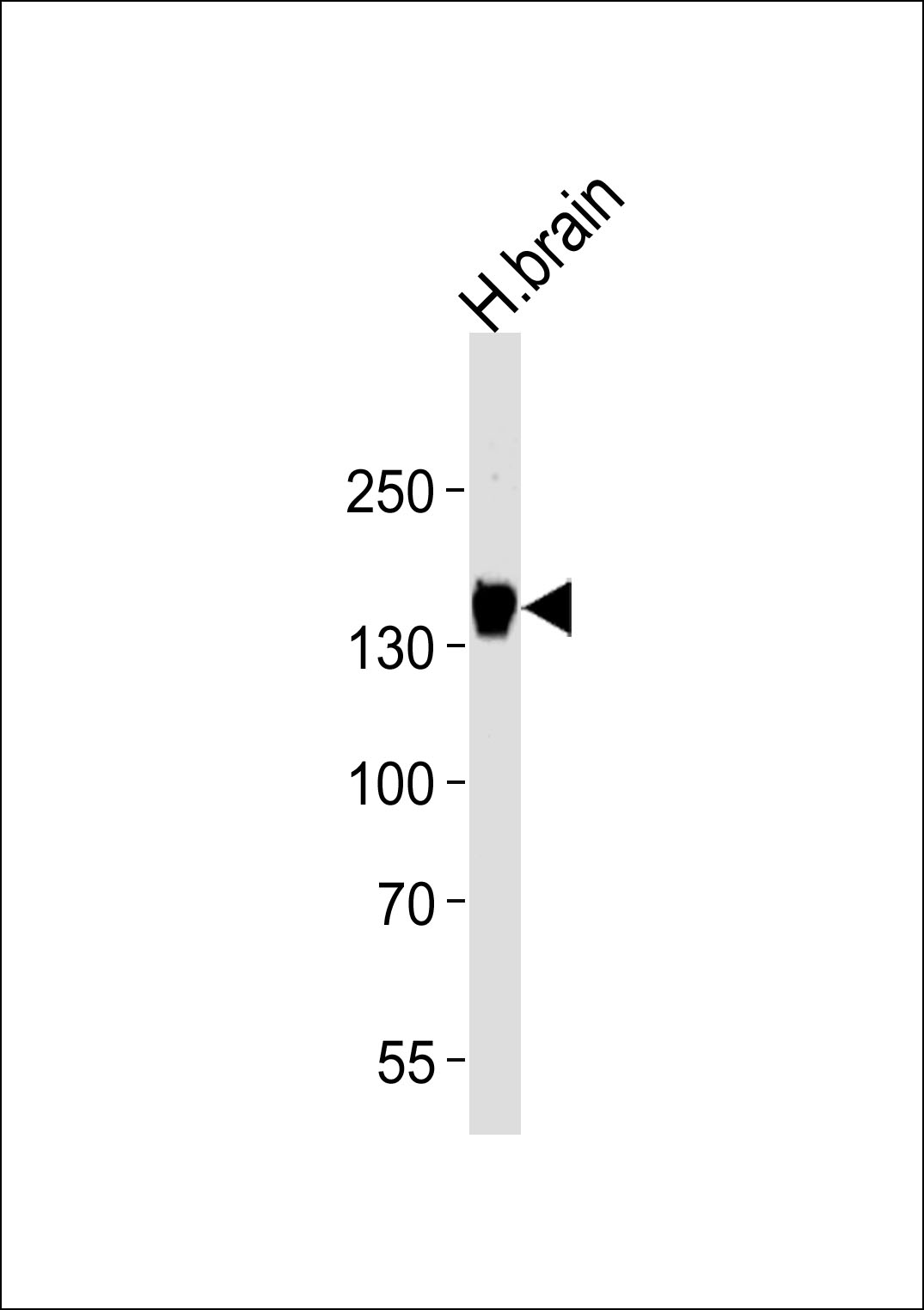 1 - GPR156 Antibody AP50062