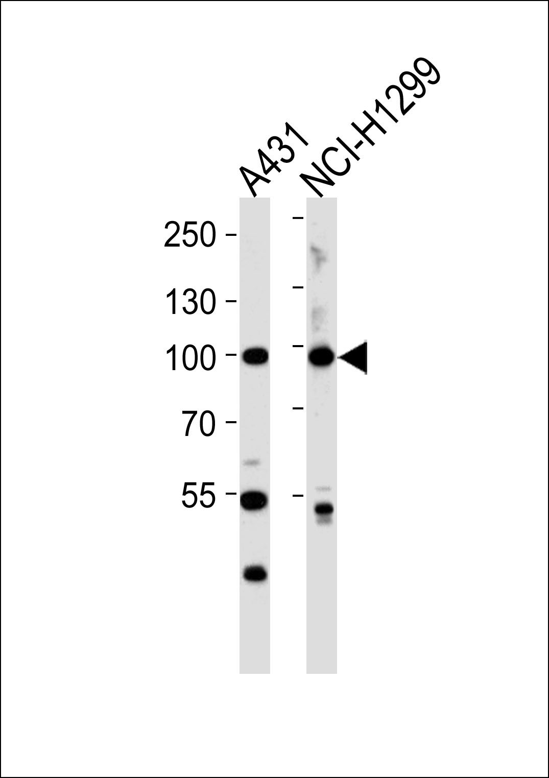 1 - FA13A (Cleaved-Gly39) Antibody AP50064