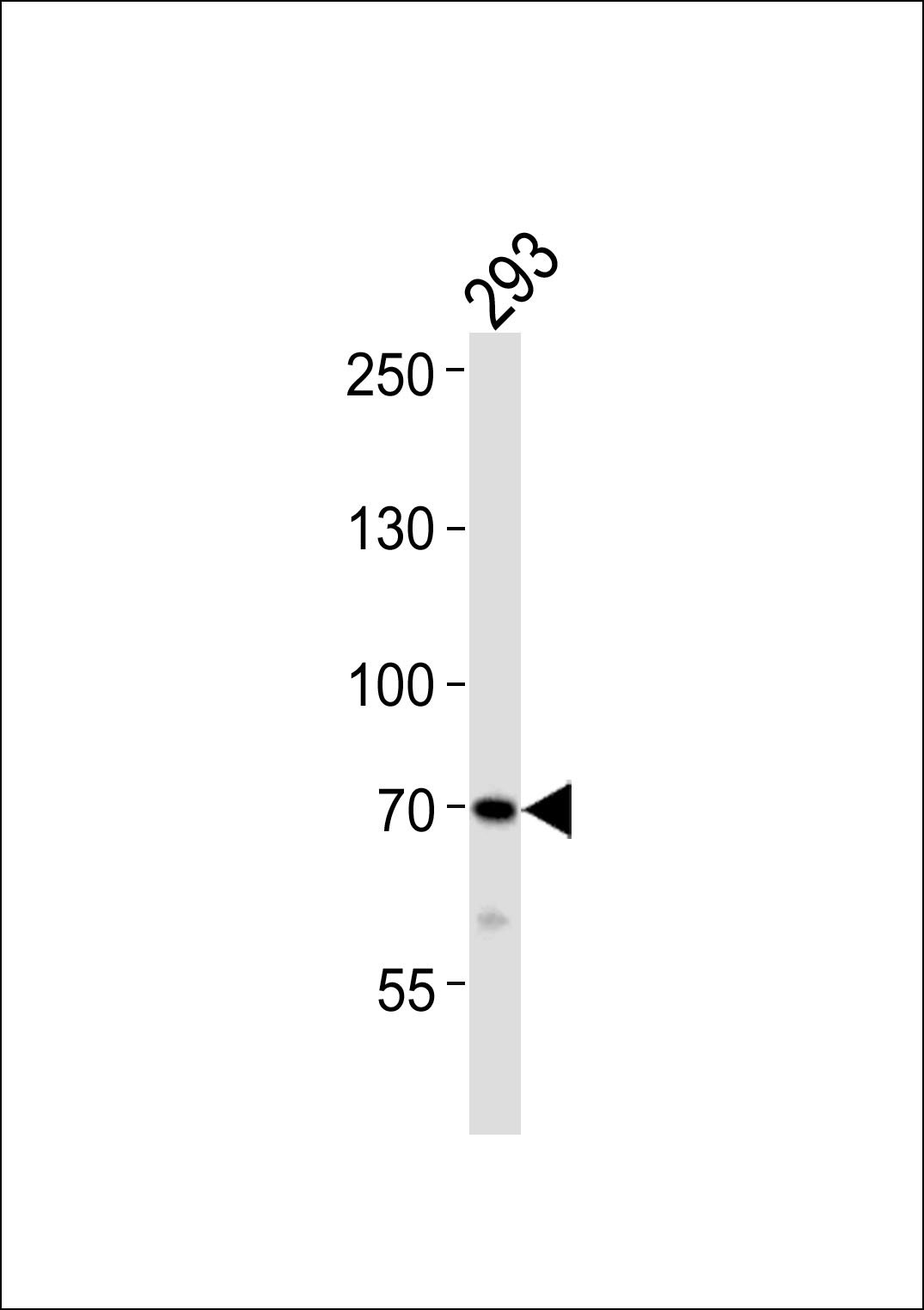 1 - DUSP16 Antibody AP50072