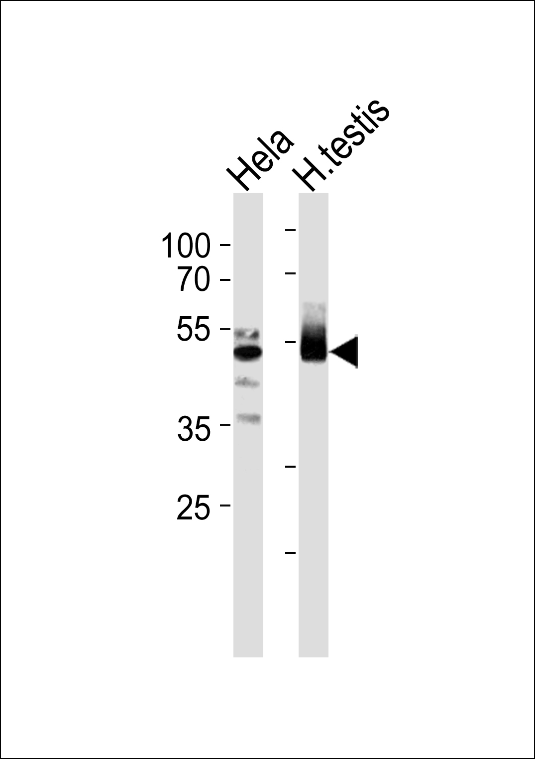 1 - TTF2 Antibody AP50207