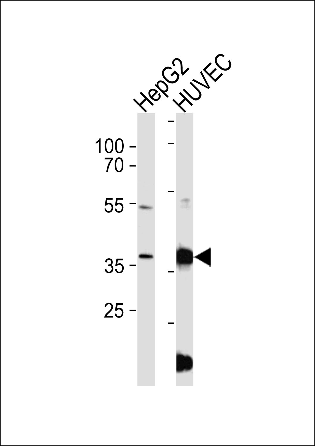 1 - B3GALT1 Antibody AP50211