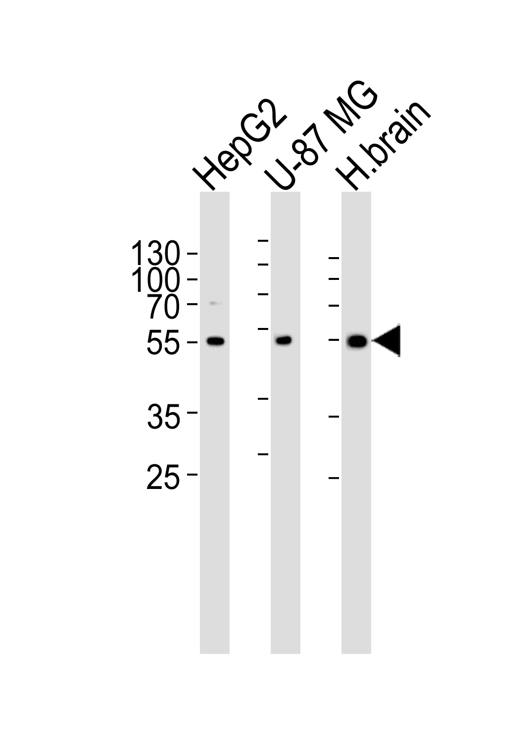 1 - RGS20 Antibody (Center) AP20629c