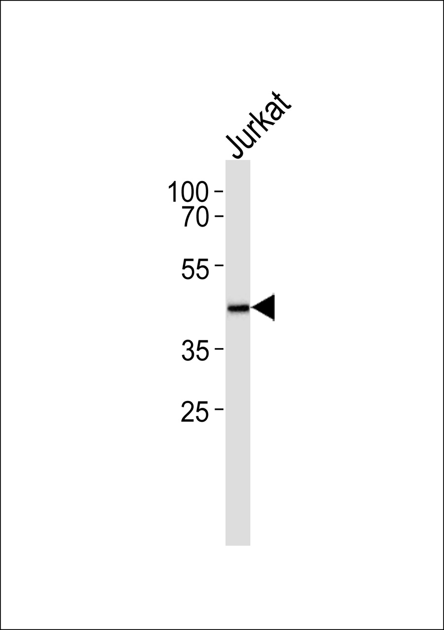 1 - PEX10 Antibody AP50591