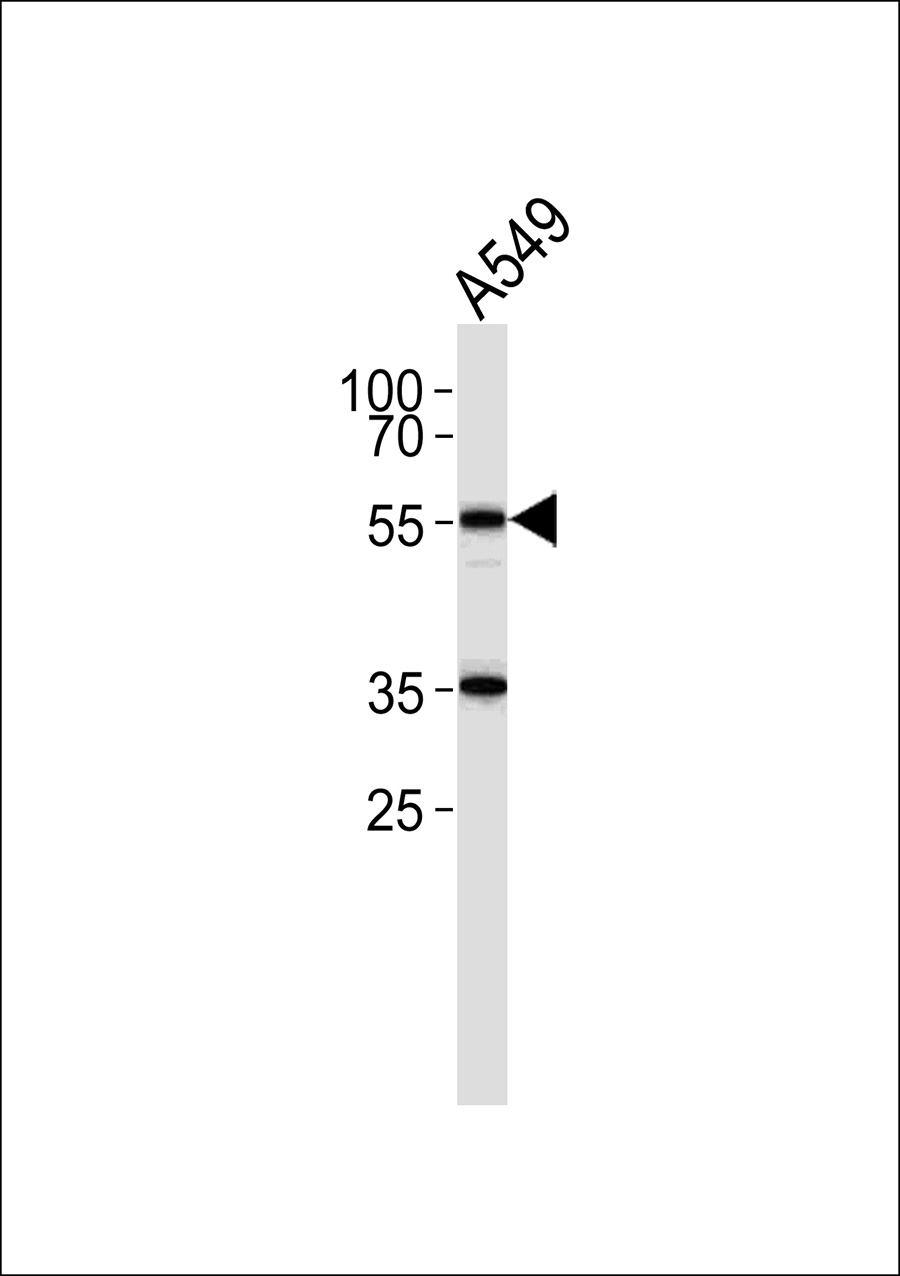 1 - FRS3 Antibody AP50598