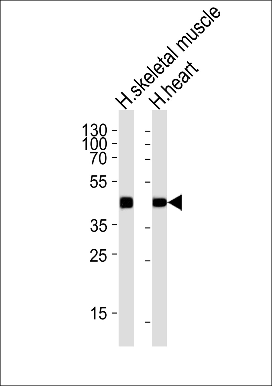 1 - NECAB3 Antibody AP50606