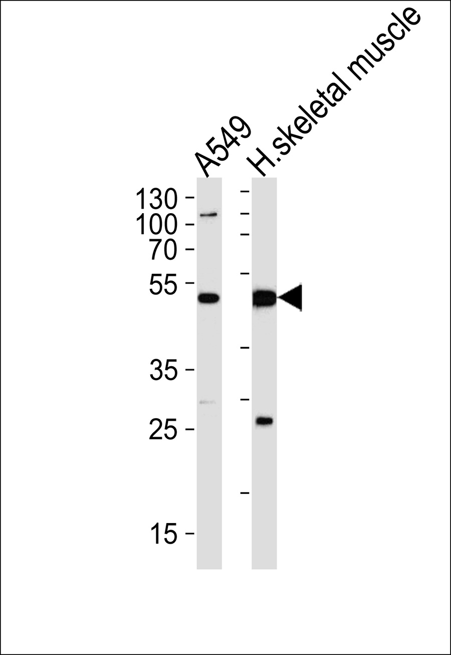 1 - NT5C1A Antibody AP50612