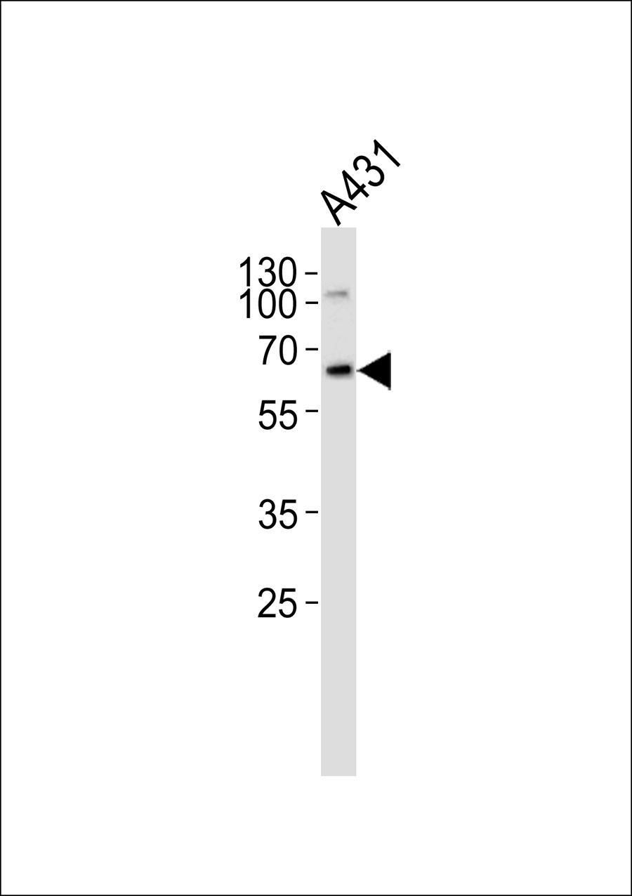 1 - MNT Antibody AP50615