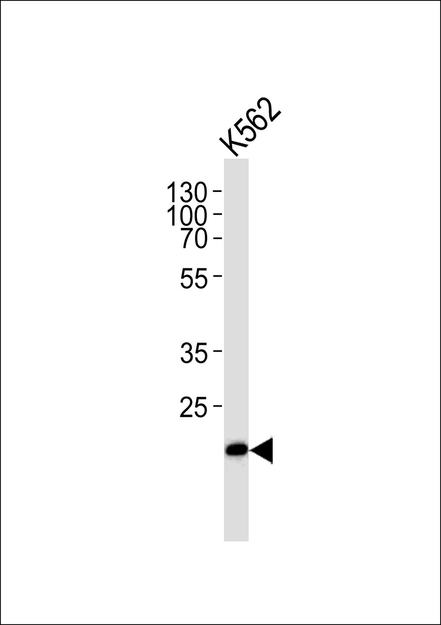 1 - THAP4 Antibody AP50652