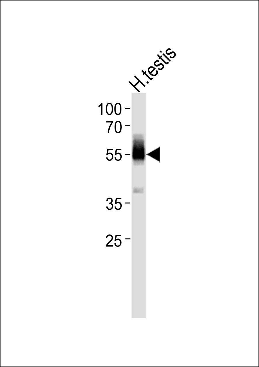 1 - ZNF232 Antibody AP50686
