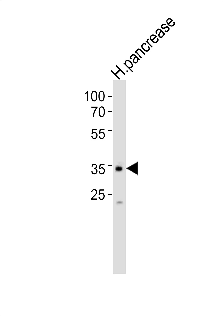 1 - ALX3 Antibody AP50690
