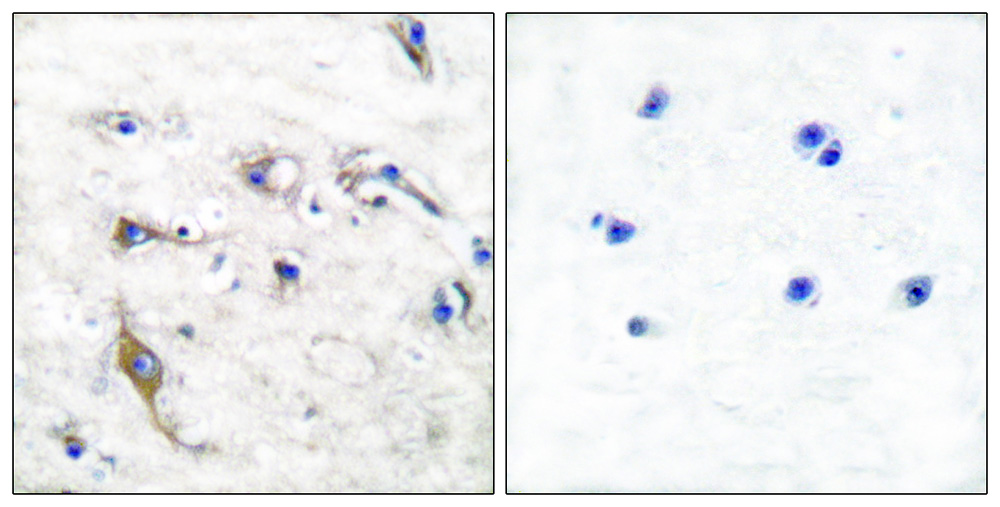 2 - JM4 Antibody AP50707
