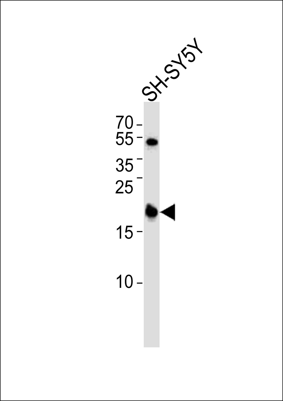 1 - JM4 Antibody AP50707