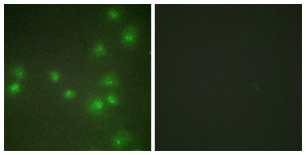 3 - ZNF265 Antibody AP50712
